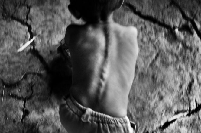 Guatemala Malnutrition - CrackedFlesh and earth blend together as a thin boy plays on the dry, cracked floor inside his family's Zacapa, Guatemala home.
