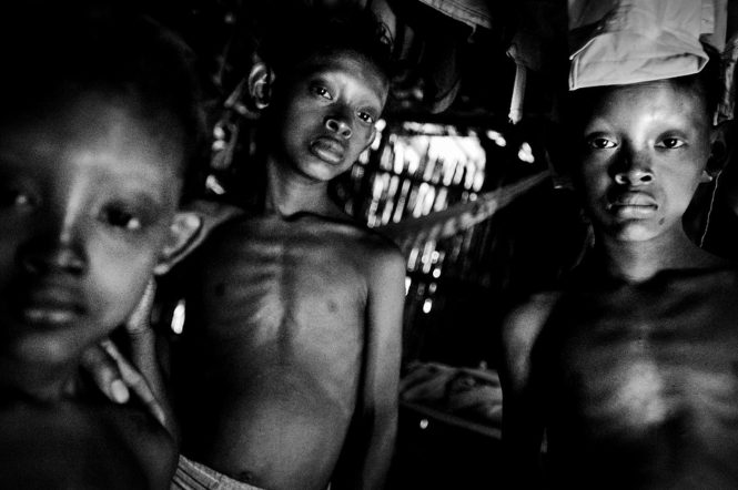 Guatemala Malnutrition - HauntedThe gaunt and haunted faces of three young brothers show the signs of malnutrition and boys who have never known anything but hunger in Zacapa, Guatemala.
